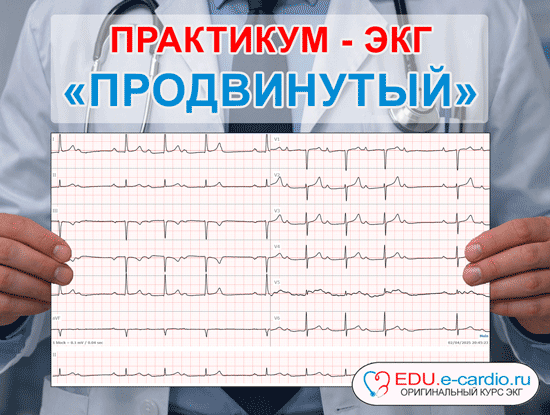 Практикум ЭКГ Продвинутый